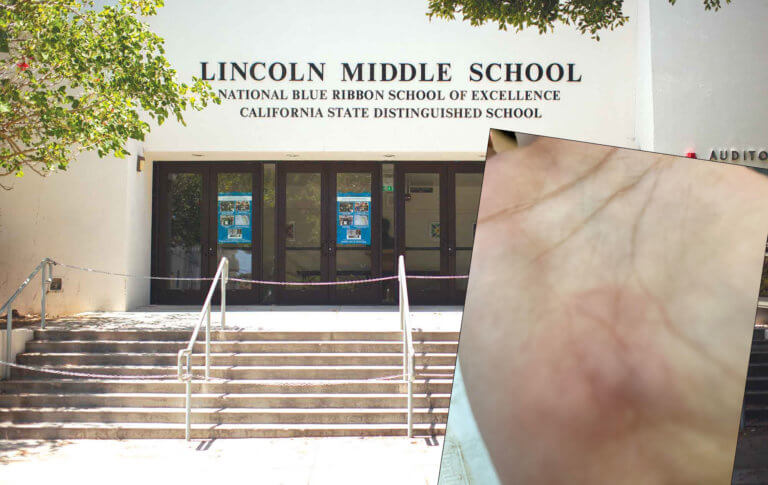 Lincoln Middle School Students Burned Doing Required P.E.